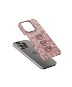 Pretty When You Bite